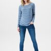 Women Esprit | Skinny Fit-Jeans Met Band Over De Buik